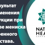 Результат применения продукции Natural health при разрыве мениска коленного сустава.